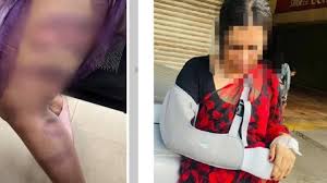 Transgender Attackedകൊച്ചിയിൽ ട്രാന്‍സ്‌ജെന്‍ഡറിനെ ഇരുമ്പ് വടികൊണ്ട് ക്രൂരമായി മര്‍ദിച്ചു; രണ്ടുപേർ പിടിയിൽ